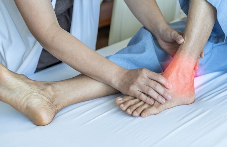 Understanding the Causes, Symptoms, and Treatment of Gout